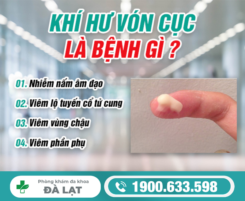 Hình ảnh minh họa